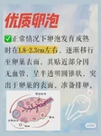 伤寒三联疫苗是灭活疫苗吗？详解疫苗类型与特点
